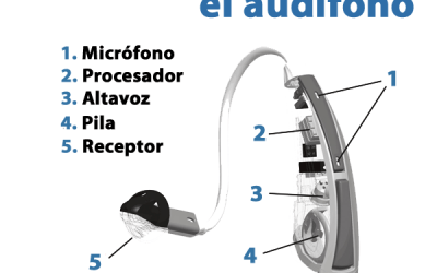 ¿Qué es un audífono y cómo funciona un audífono?